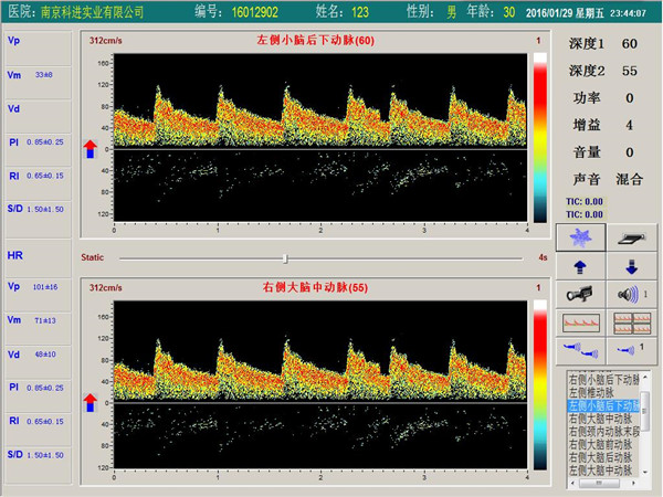 經(jīng)顱多普勒雙通道，單深度界面