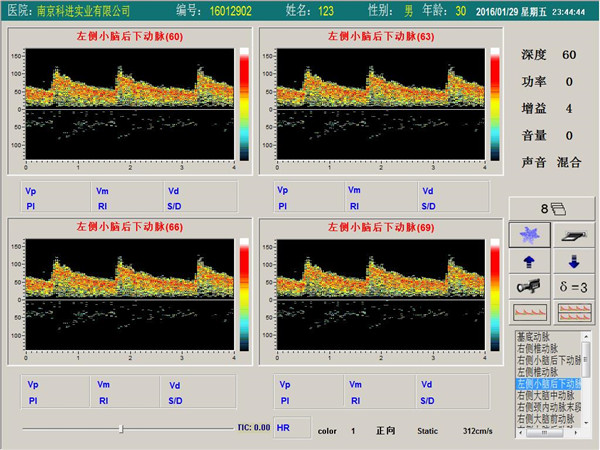 經(jīng)顱多普勒單通道，四深度界面