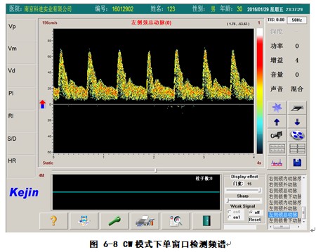 經顱多普勒軟件cw模式下檢測界面.JPG