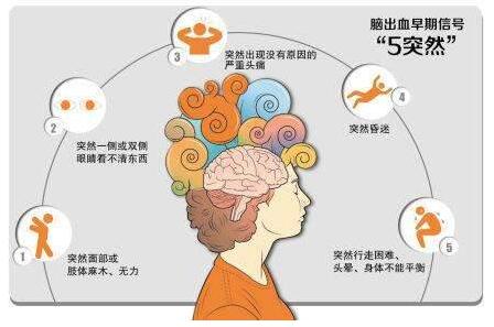 心腦血管病別等發(fā)作才篩查，經(jīng)顱多普勒TCD超聲檢測(cè)心腦血管