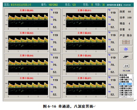 經(jīng)顱多普勒軟件單通道八深度檢測界面